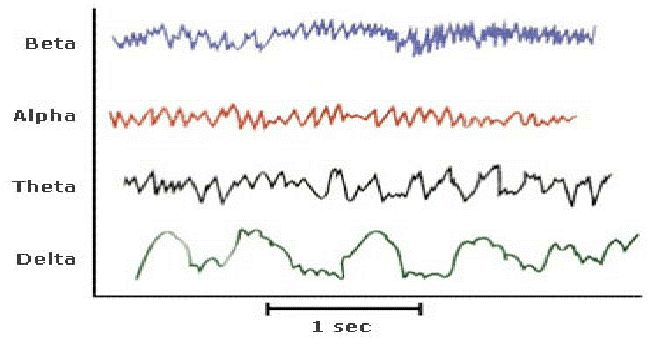 EEG